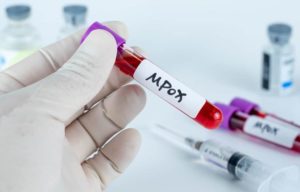 La OMS cambia el nombre de la viruela del mono, ahora se denomina “mpox”