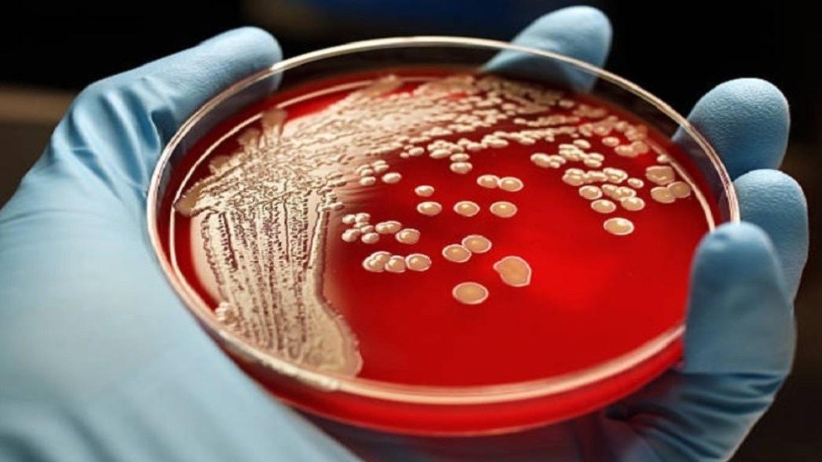 La bacteria Carnívora: Un misterio que asombra al mundo