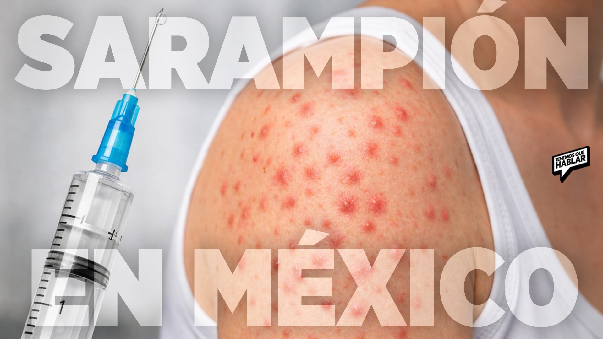 Una alerta silenciosa: México podría perder su estatus libre de sarampión